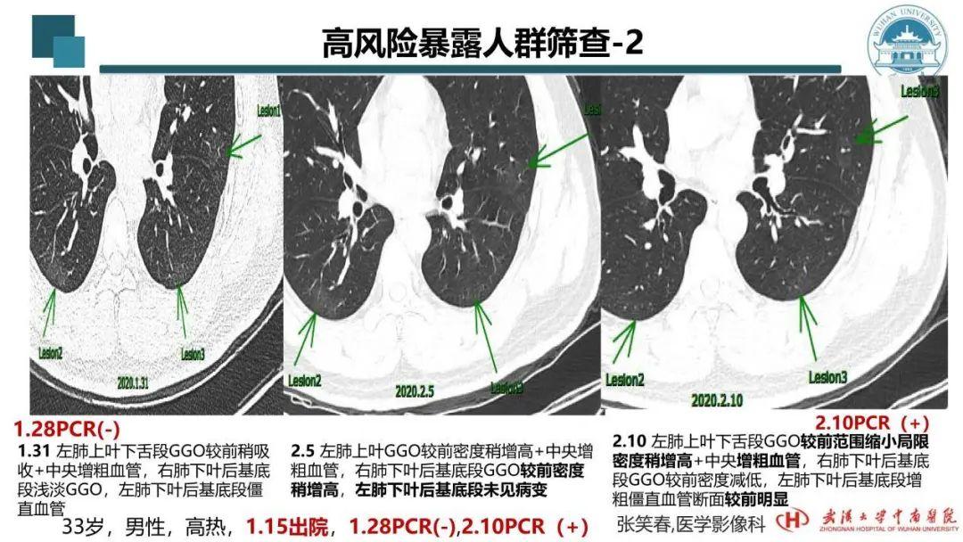 战疫先锋：新增康复肺炎病例喜讯传来