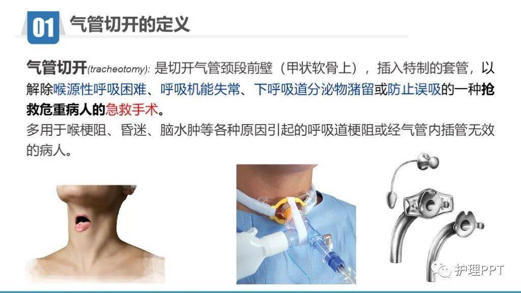 最新气管切开护理指南PPT