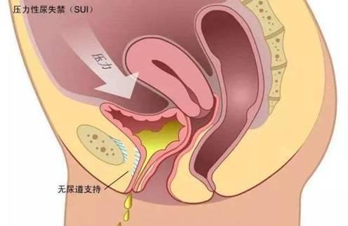 湘雅四院最新动态速递：权威资讯一网打尽